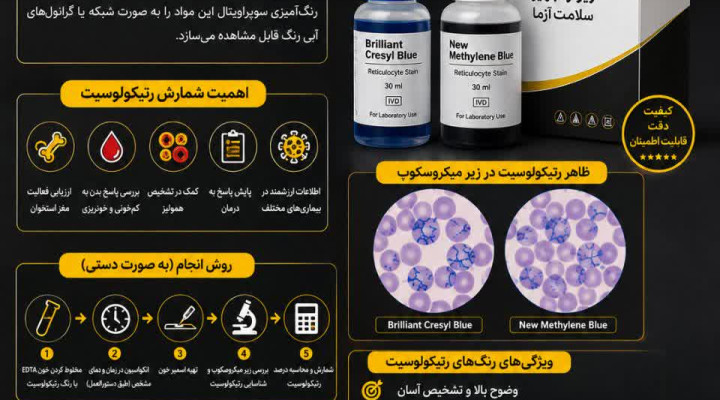رنگ‌آمیزی رتیکولوسیت چیست؟ بررسی علمی روش رنگ‌آمیزی و شمارش رتیکولوسیت