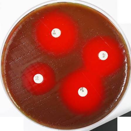 محیط کشت مولر هینتون بلاد آگار (Mueller Hinton Blood Agar)