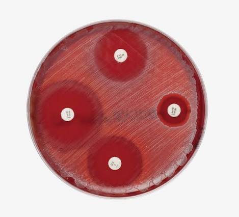 محیط کشت مولر هینتون بلاد آگار (Mueller Hinton Blood Agar)
