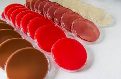 محیط کشت شکلات آگار / chocolate agar