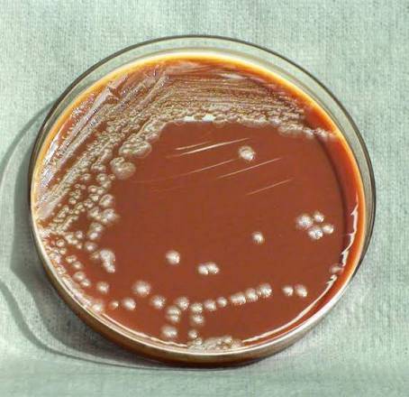 محیط کشت شکلات آگار / chocolate agar