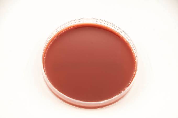 محیط کشت شکلات آگار / chocolate agar