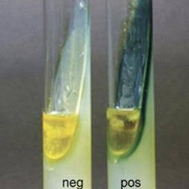 محیط کشت فنیل آلانین / phenylalanine agar
