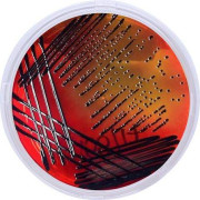 محیط کشت ایکس ال دی / XLD
