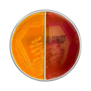 محیط کشت ترکیبی XLD / Hektoen Enteric Agar (دو محیط در یک پلیت) 8cm