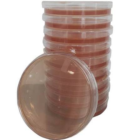 محیط کشت SS Agar (سالمونلا -شیگلا)