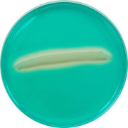 محیط کشت SS Agar (سالمونلا -شیگلا)