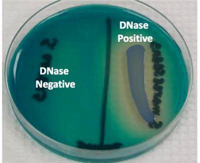 محیط کشت SS Agar (سالمونلا -شیگلا)