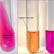 محیط کشت اوره آگار urea agar *